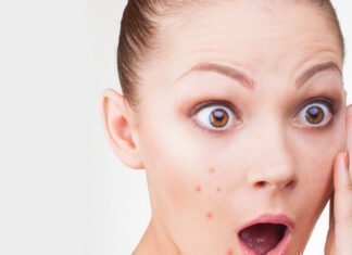 Εμφανίστηκαν ξαφνικά σπυράκια και δεν ξέρεις τι να κάνεις