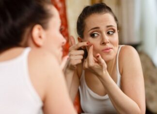 Ακμή στο πρόσωπο