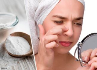 Τι συνιστούν οι δερματολόγοι για τη χρήση της μαγειρικής σόδας στο πρόσωπό μας.