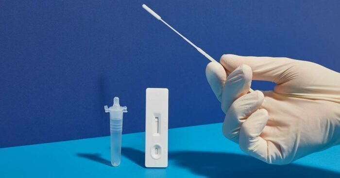 Από Τετάρτη 29 Δεκεμβρίου οι έλεγχοι για rapid τεστ σε εργαζόμενους