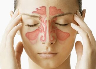 Ιγμορίτιδα: 6 ένοχες αιτίες που πρέπει να γνωρίζετε