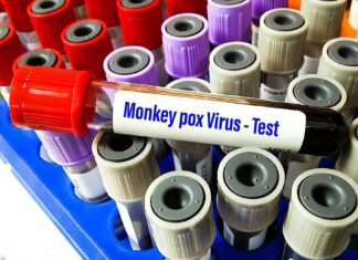 «Κρατάει 4 εβδομάδες, χρειάζεται καραντίνα»