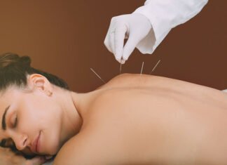 Πονοκέφαλοι τάσης: Πόσο μειώνει τα συμπτώματα ο βελονισμός