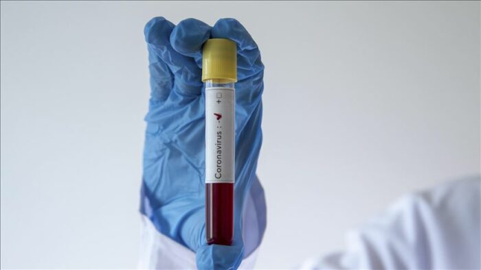 Ρεκόρ νέων κρουσμάτων COVID-19 στην Ιαπωνία – Προβληματισμός για τον αριθμό ασθενών στις Φιλιππίνες