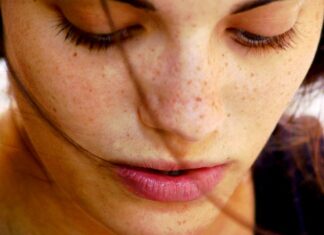 Φυσικοί τρόποι αντιμετώπισης των πανάδων