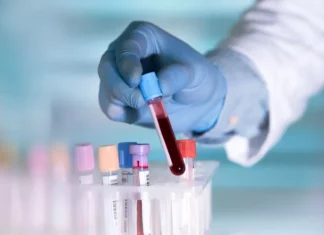 Περίπου 40% αίματος δίδεται σε αιμοσφαιρινοπαθείς