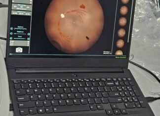Στην Κύπρο η πρώτη συσκευή ψηφιακής απεικόνισης παιδικού / βρεφικού ματιού