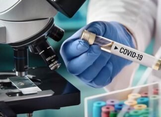 Δρ. Χαραλάμπους: Μικρή έξαρση κρουσμάτων COVID-19 καταγράφεται το τελευταίο διάστημα στην Κύπρο