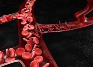 Δρεπανοκυτταρική Αναιμία: Ο FDA ενέκρινε δυο θεραπείες-ορόσημο για την οριστική θεραπεία της νόσου