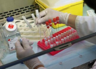 Ανακάλυψη τεσσάρων νέων συνδυασμένων στελεχών HIV-1 στην Κύπρο