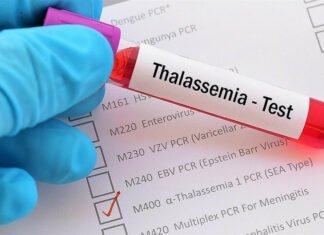 H ΔΟΘ χαιρετίζει την πρώτη γονιδιακή θεραπεία για τη β-θαλασσαιμία