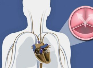 Τα μυστικά της αορτικής βαλβίδας