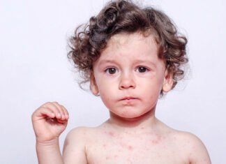 Σε εγρήγορση τα σχολεία για κρούσματα ιλαράς