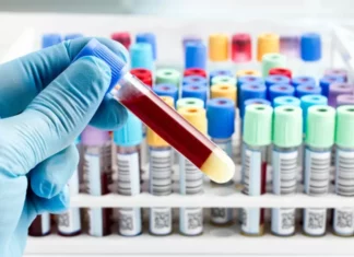 Άρχισε η επέκταση του ωραρίου λειτουργίας των κλινικών εργαστηρίων στον ΟΚΥΠΥ