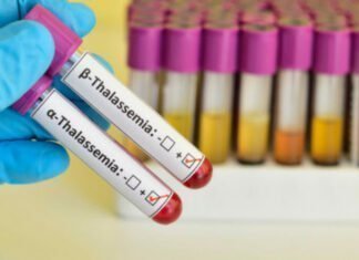 Υπουργός Υγείας: Αυξητική η τάση των ασθενών με αιμοσφαιρινοπάθειες στην Κύπρο