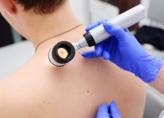 Χορηγούνται στη Βρετανία τα πρώτα εξατομικευμένα εμβόλια κατά του μελανώματος