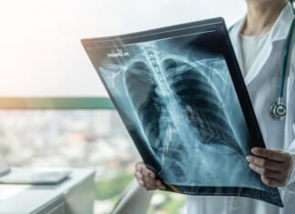 Αναβαθμίζεται το Ακτινολογικό του Νοσοκομείου Λευκωσίας