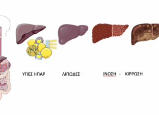 Λιπώδες ήπαρ: Ώρα για ενημέρωση και επαγρύπνηση