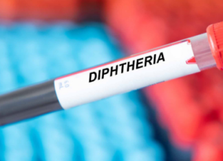 Συμφωνία για κοινή προμήθεια φαρμάκου για τη διφθερίτιδα υπέγραψε η ΕΕ