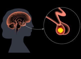Ενδοκρινολογική Εταιρεία: Όλα όσα πρέπει να γνωρίζετε για τις παθήσεις της υπόφυσης