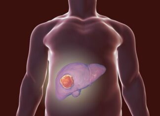 Την πρόληψη έναντι του καρκίνου του ήπατος προκρίνει ο «Προμηθέας»