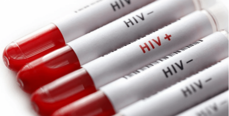 hiv e17340321633271