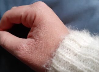 Χειμερινή περιποίηση: Πώς να προστατεύσετε την επιδερμίδα σας από το κρύο