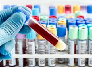 Σε μια βάση δεδομένων θα καταχωρούνται πλέον οι κλινικές δοκιμές εντός Ευρωπαϊκής Ένωσης