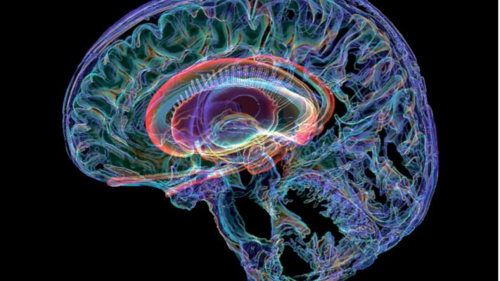 amygdala autism1