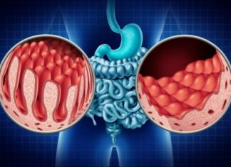 Σταθερό μηνιαίο επίδομα για ασθενείς εισηγείται ο Σύνδεσμος Κοιλιοκάκης Κύπρου