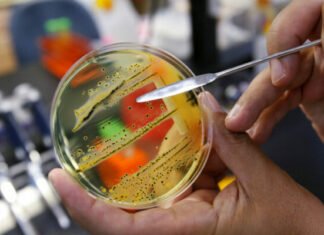 Προσοχή: Εντοπίστηκε σαλμονέλα σε προϊόν στην κυπριακή αγορά