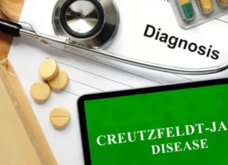 Τι είναι η νόσος CJD από την οποία πέθανε άτομο στα κατεχόμενα και πως μεταδίδεται