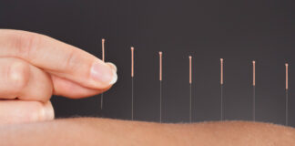 «Η Κύπρος κινδυνεύει να γίνει περίγελος της Ευρώπης» – Να αποσυρθεί πρόταση νόμου για το βελονισμό