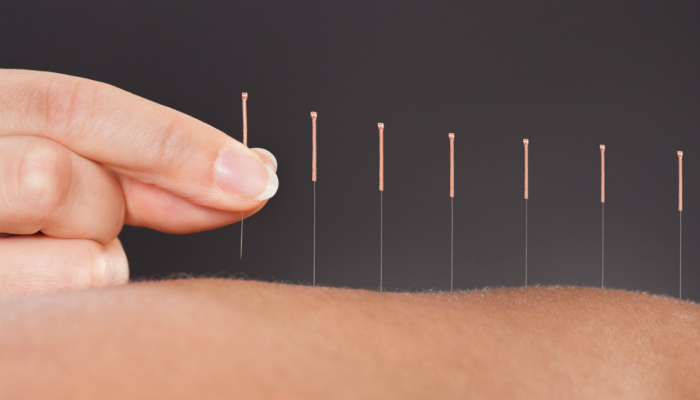 «Η Κύπρος κινδυνεύει να γίνει περίγελος της Ευρώπης» – Να αποσυρθεί πρόταση νόμου για το βελονισμό