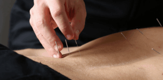 ΟΣΑΚ και ΕΒΦΚ ζητούν απόσυρση της πρότασης νόμου για φυσικοπαθητική και βελονισμό