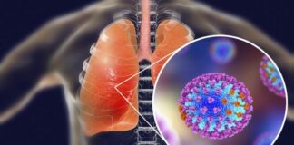 Πρώτος θάνατος από γρίπη στην Κύπρο – Αυξάνονται οι εισαγωγές στα νοσοκομεία