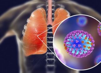 Πρώτος θάνατος από γρίπη στην Κύπρο – Αυξάνονται οι εισαγωγές στα νοσοκομεία