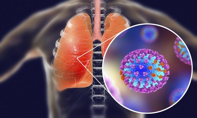 Πρώτος θάνατος από γρίπη στην Κύπρο – Αυξάνονται οι εισαγωγές στα νοσοκομεία