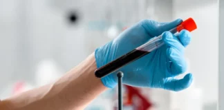 Νέα κυτταρική θεραπεία προσφέρει ελπίδα σε ασθενείς με ηπατική νόσο
