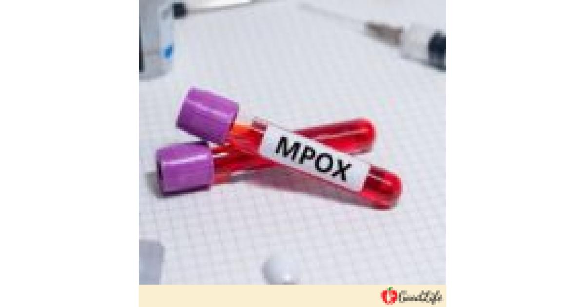 Ανακοίνωση Υπουργείου Υγείας για την νόσο Mpox ( Ευλογιά των Πιθήκων ) – Ό,τι πρέπει να γνωρίζεις